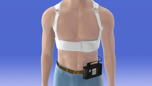 ZOLL LifeVest: A Wearable Cardioverter Defibrillator for Patients at Risk of Sudden Cardiac Arrest